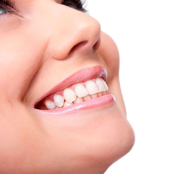 How to look amazing from the inside out Patients with a history of cavities or gum disease