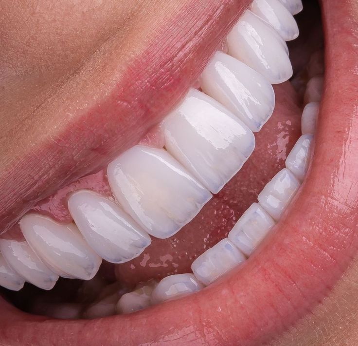 Răng đều như hạt bắp – Bí quyết chuẩn chỉnh cho nụ cười bạn Seniors managing age-related dental concerns